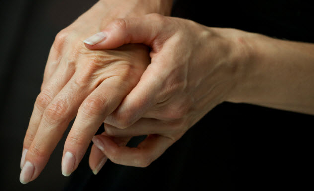 6-arthritis_000012913558_Small