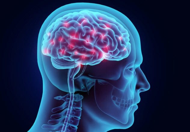 4a-brain-activity-514261002