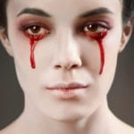 Top 10 Rare And Quirky Finds From The Medical World