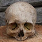 10 Weird But Fascinating Problems Faced By Ancient People